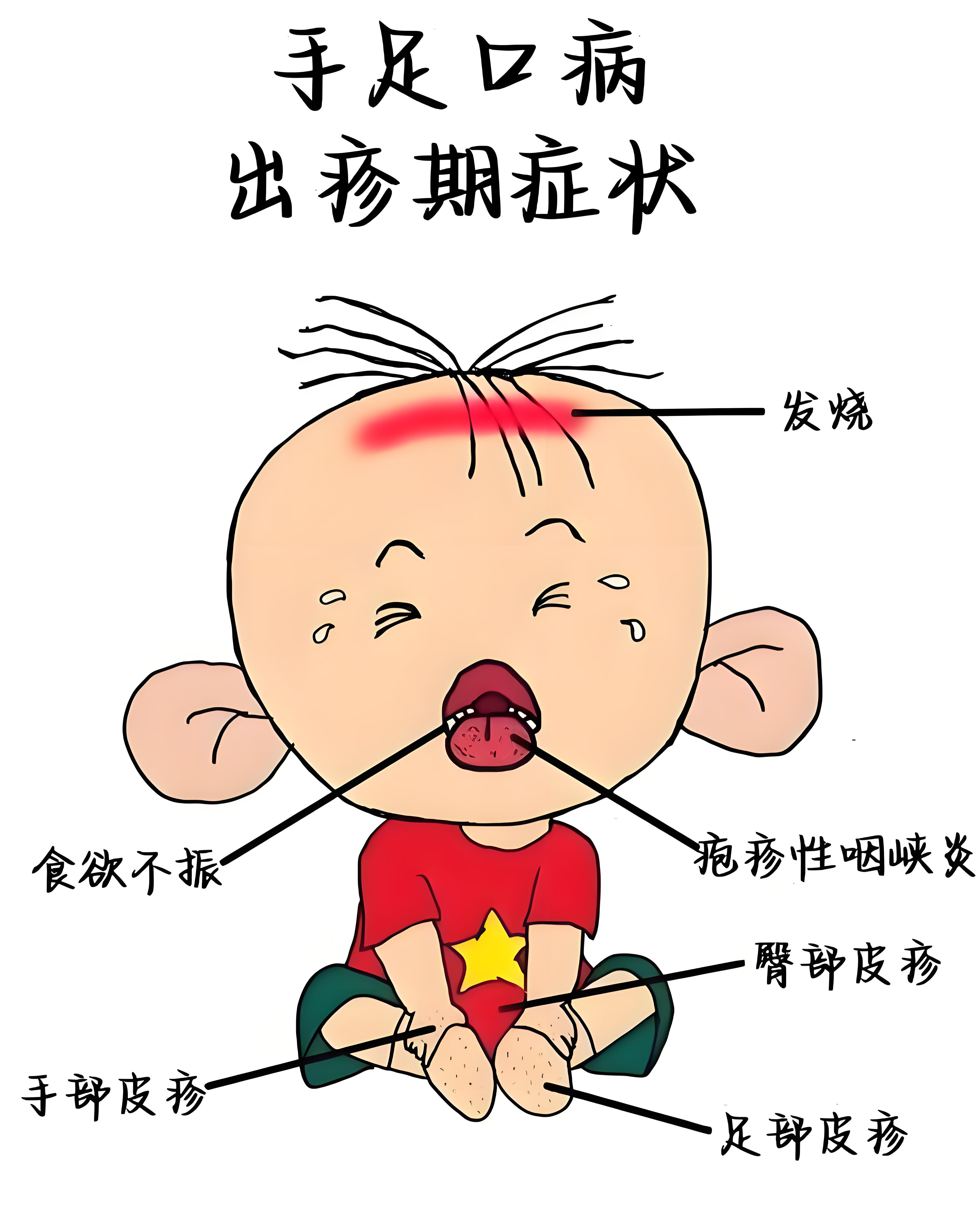 孩子嘴里长疱疹就是得了手足口病？不一定，别忽略它→